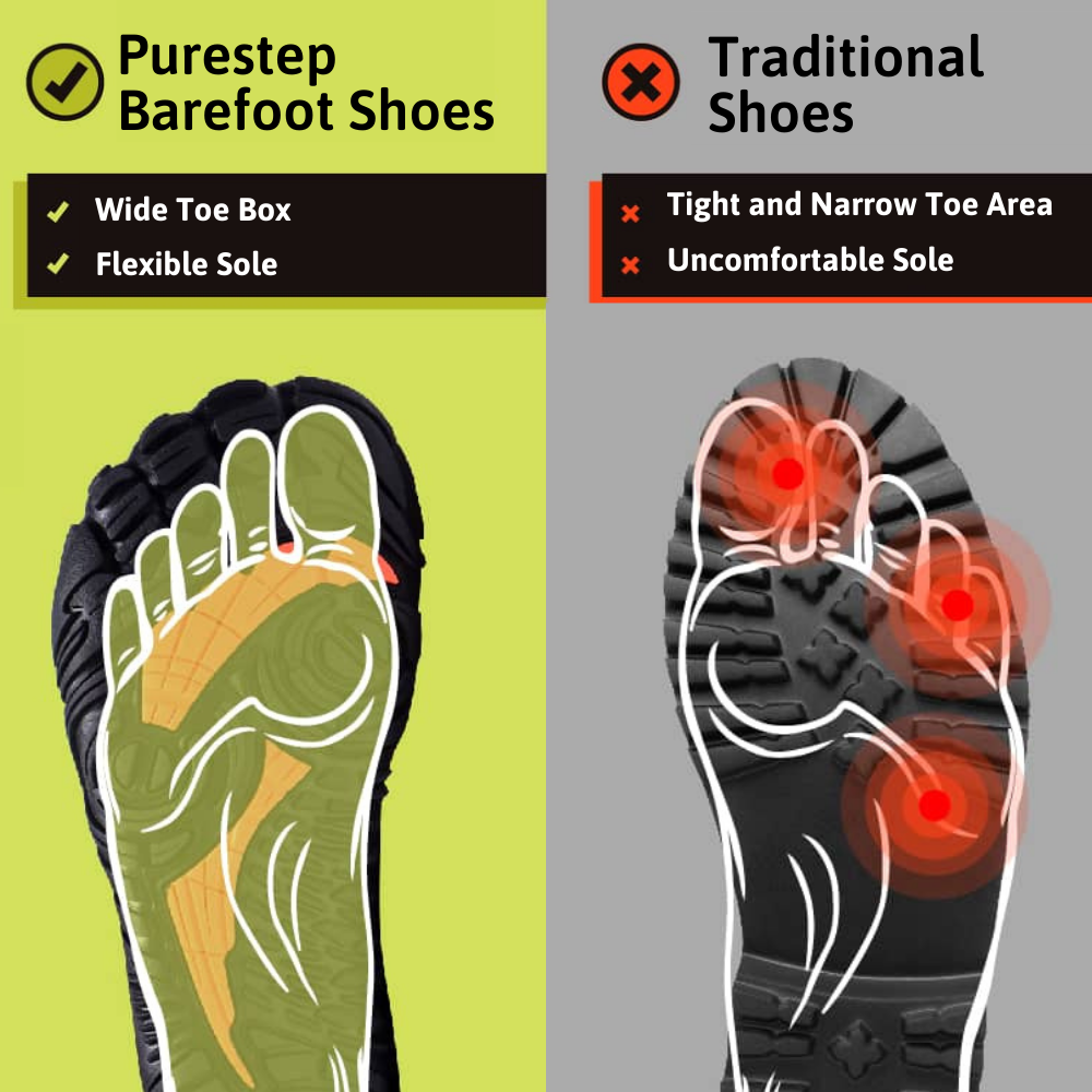 Wear Pattern Foot Pronation Shoes Shoe Wear Flat Feet